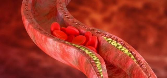 Co jest w stanie obniżyć zły cholesterol?