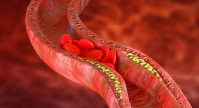 Co jest w stanie obniżyć zły cholesterol?
